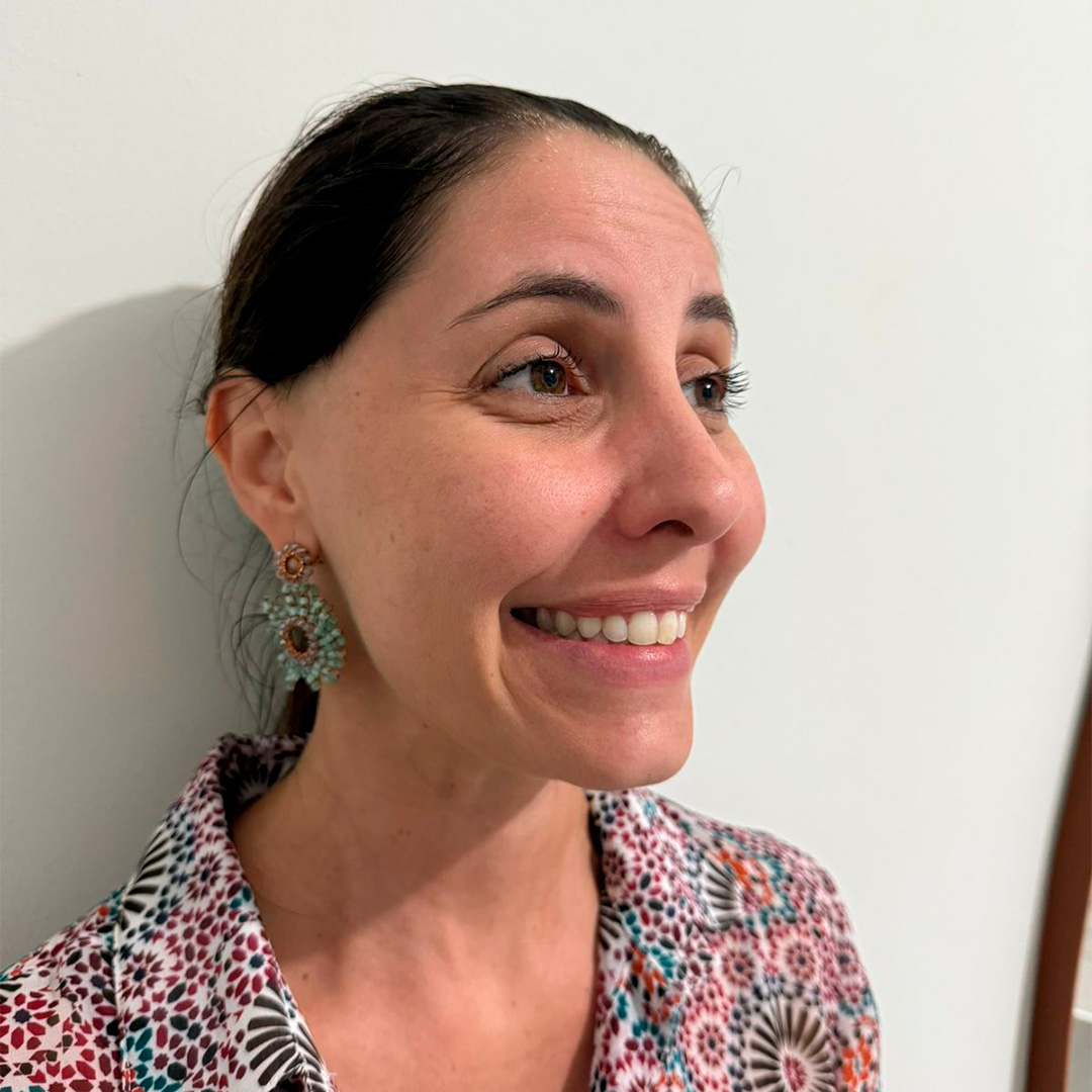 Mulher de perfil mostrando o sorriso antes do procedimento em clinica de estetica