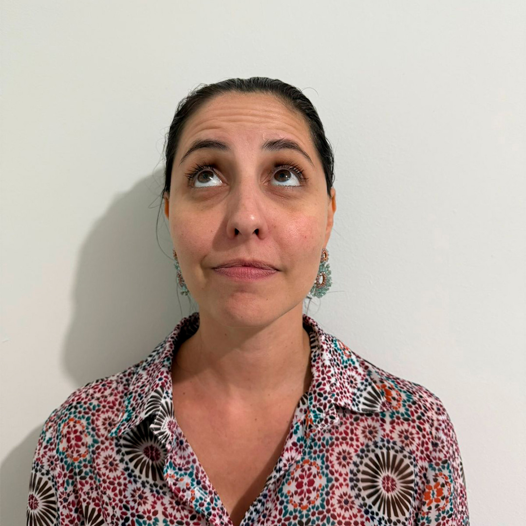 Mulher olhando para cima para mostrar olheiras antes do procedimento em clinica de estetica